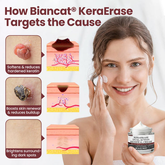 Biancat® KeraErase Dual-Action Renewal Cream