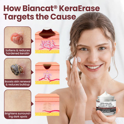 Biancat® KeraErase Dual-Action Renewal Cream
