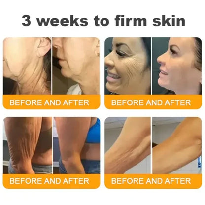 LOVILDS™ Bee Venom Skin Restoration Cream