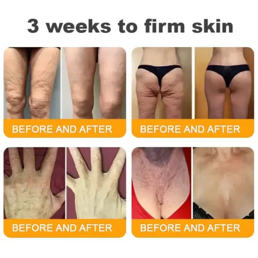 LOVILDS™ Bee Venom Skin Restoration Cream