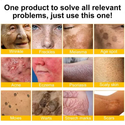 LOVILDS™ Bee Venom Skin Restoration Cream